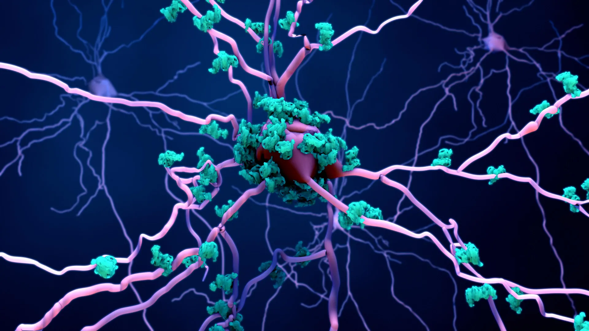Scientists Find New Brain Cell Death Mechanism Behind Alzheimer's