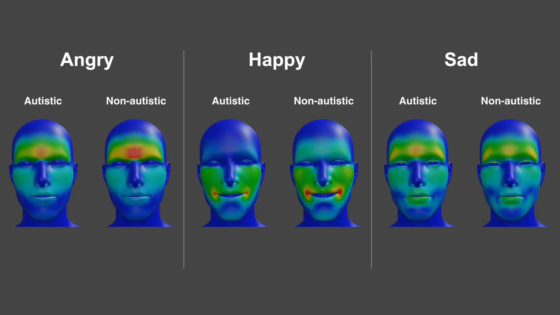 Why Emotional Expressions Differ in Autism