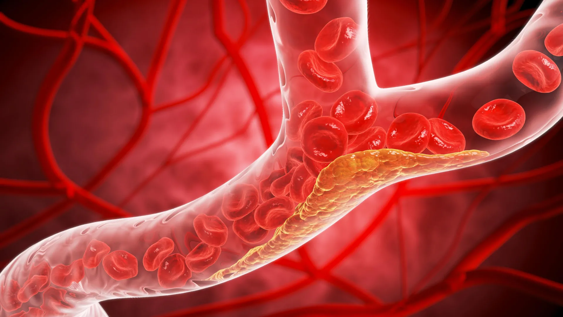 Type 2 Diabetes Quietly Damages Blood Vessels