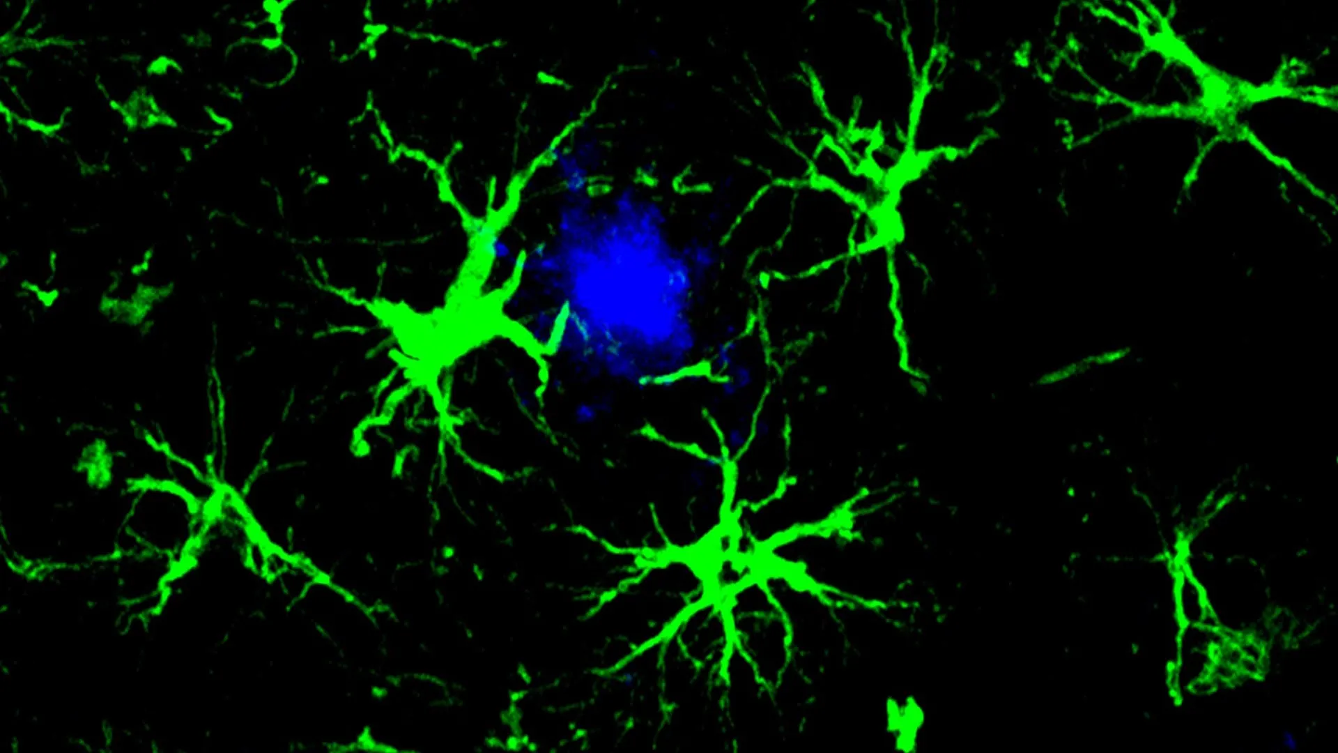 Brain Cells Engineered To Fight Alzheimer’s