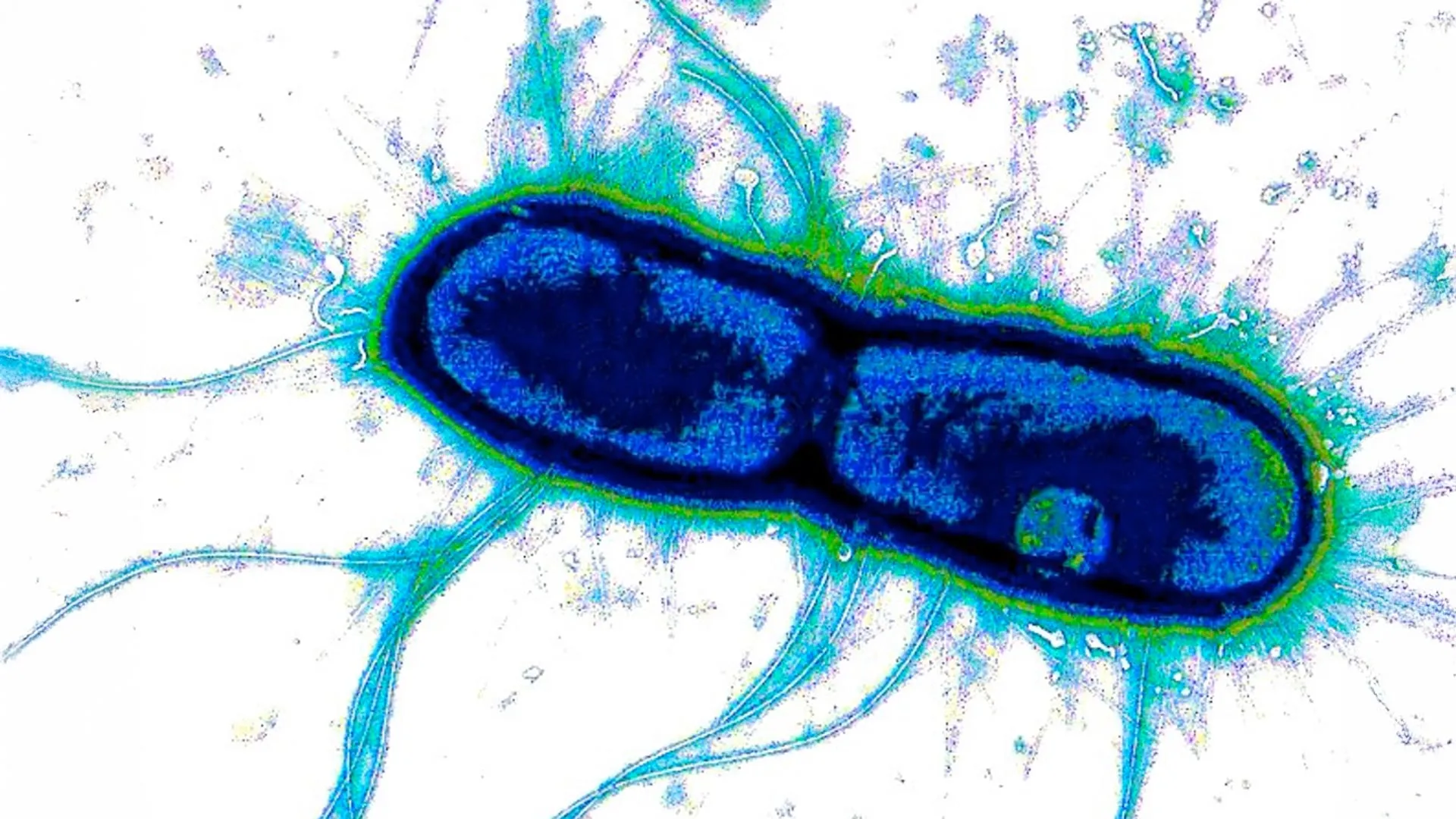 The Achilles’ Heel of Deadly Bacteria