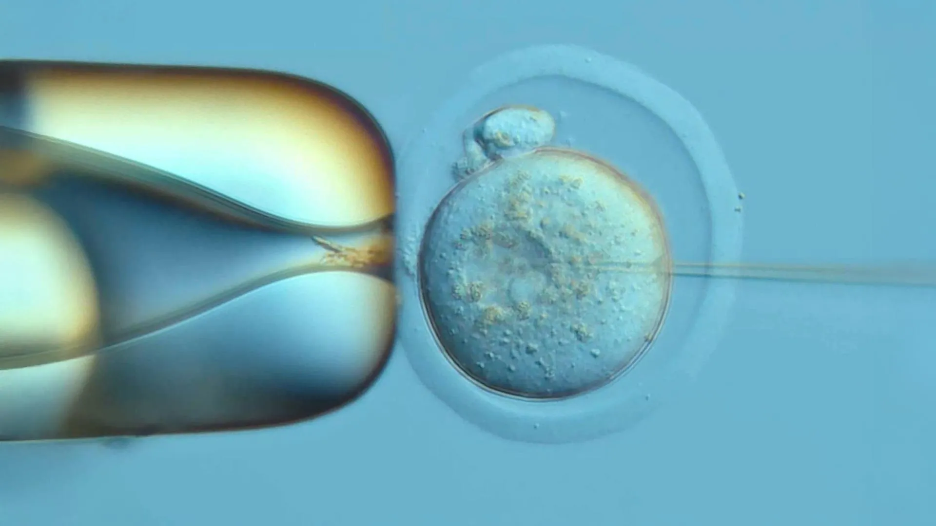 DNA recording system reveals how a single cell becomes a body