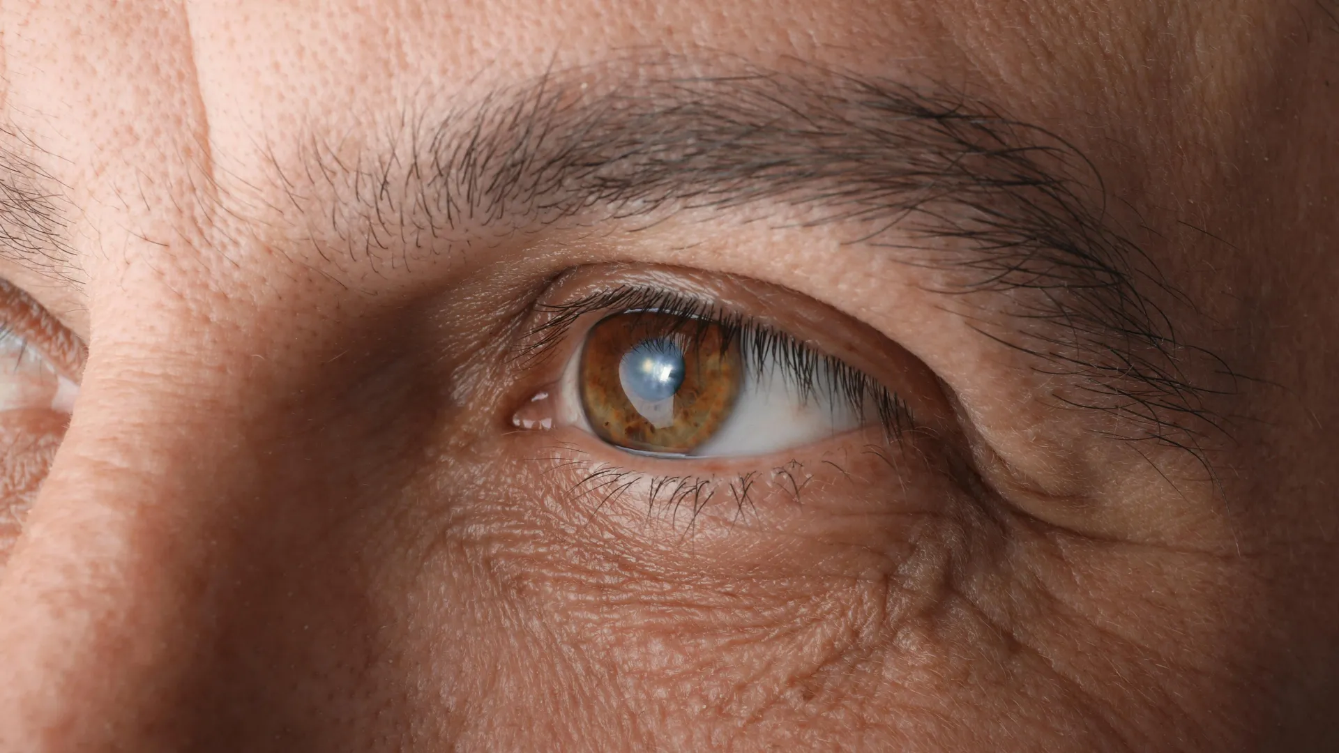 Cialis Linked to Higher Glaucoma Risk, Study Finds