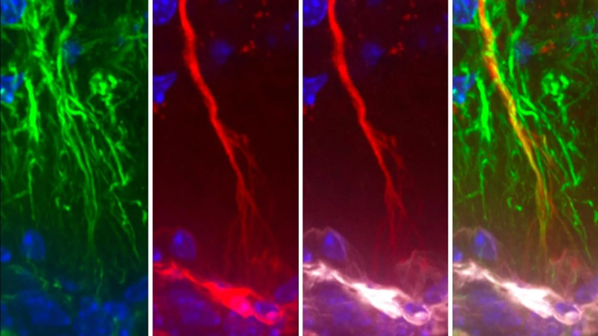 Scientists discover hidden brain cells that may stop Alzheimer’s tau buildup | ScienceDaily