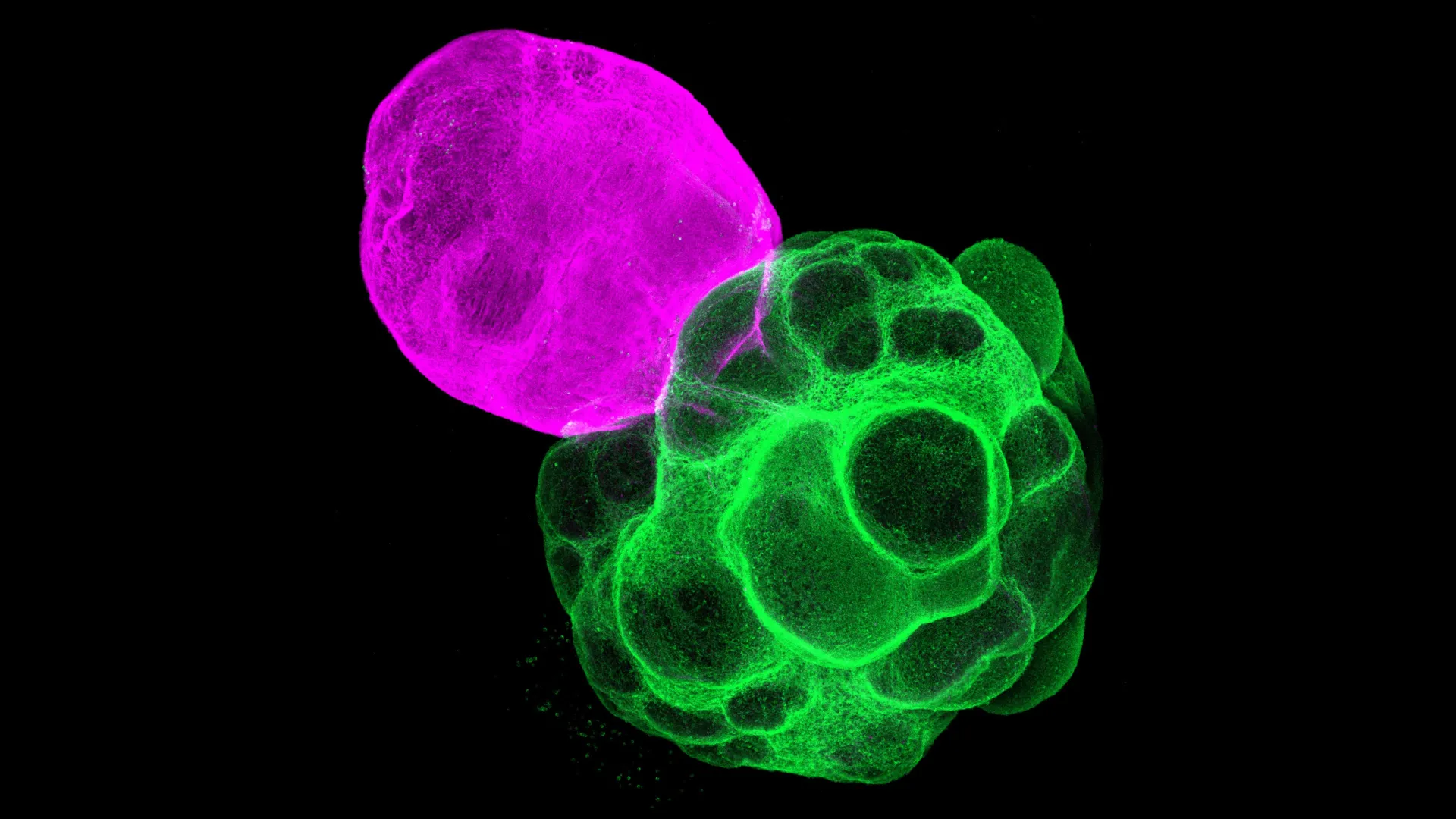 Japanese scientists just built human brain circuits in the lab | ScienceDaily